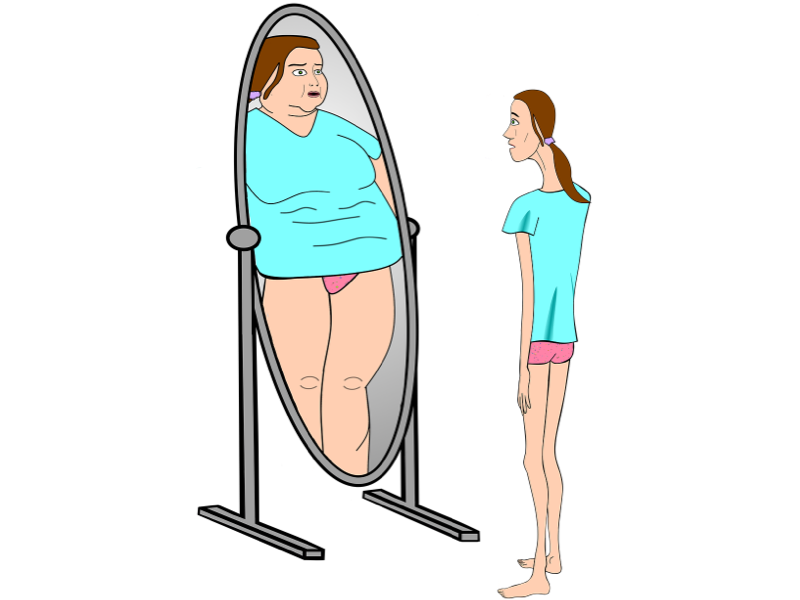 A woman looking in the mirror with an eating disorder
